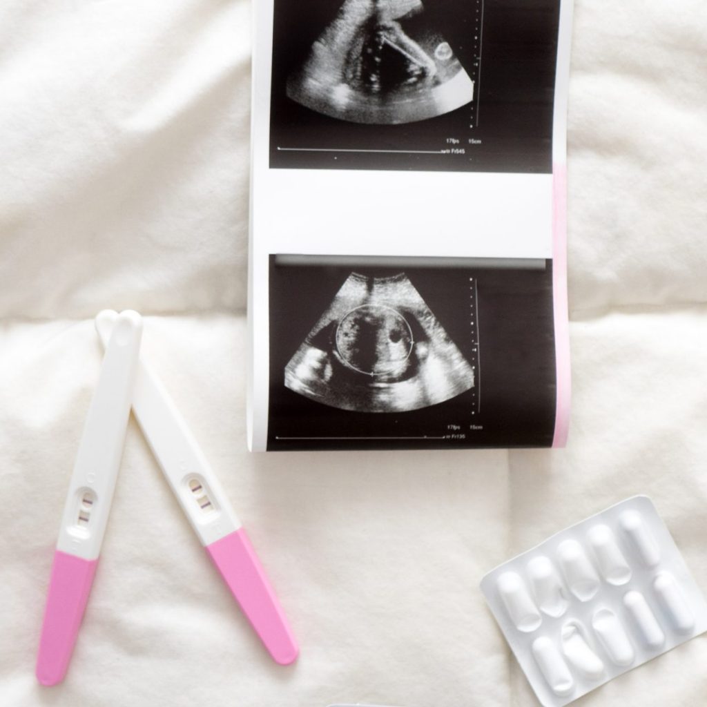 Pregnancy tests, baby clothes and an ultrasound scan laid out on a bed